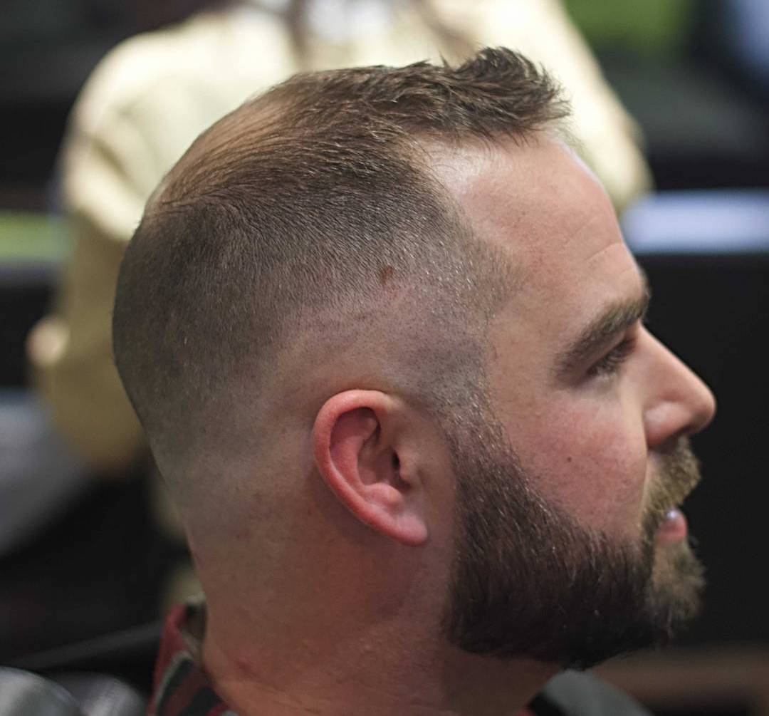 modèle de coupe de cheveux homme dégarni avec calvitie avancée sur vertex les golfes et barbe courte