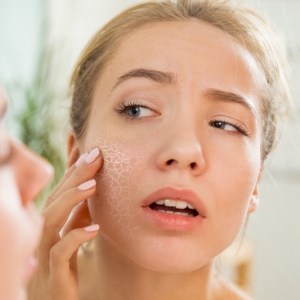 Comment hydrater une peau très sèche naturellement ?