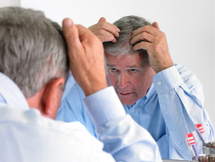 man examining hairline