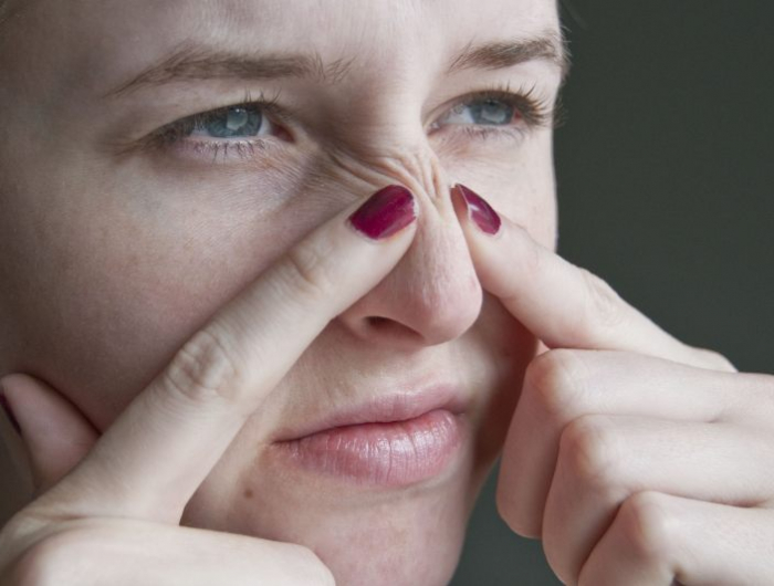 pores dilates solution radicale une femme qui extrait un point noir