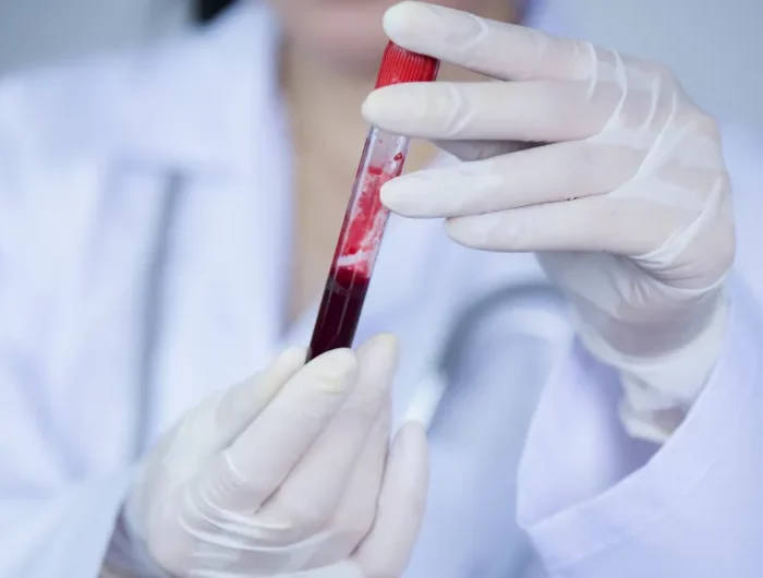 comment fluidifier le sang par lalimentation tube de sang gants blanc