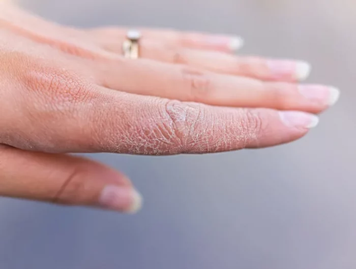comment proteger la peau de ses mains pendant l hiver