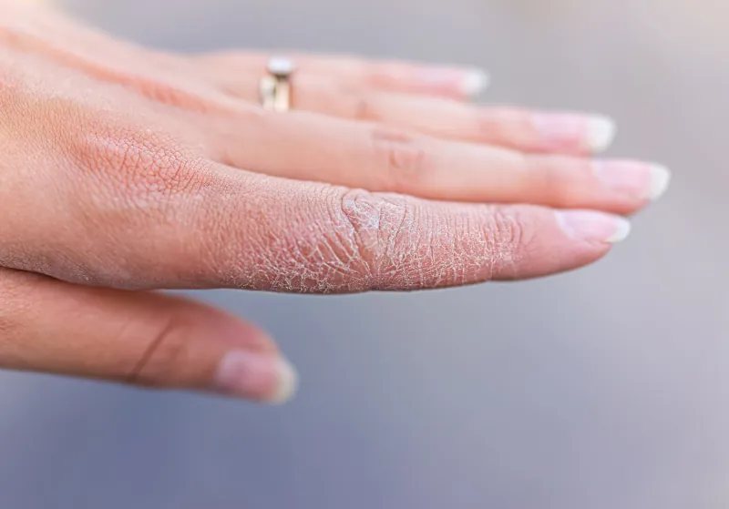 comment proteger la peau de ses mains pendant l hiver