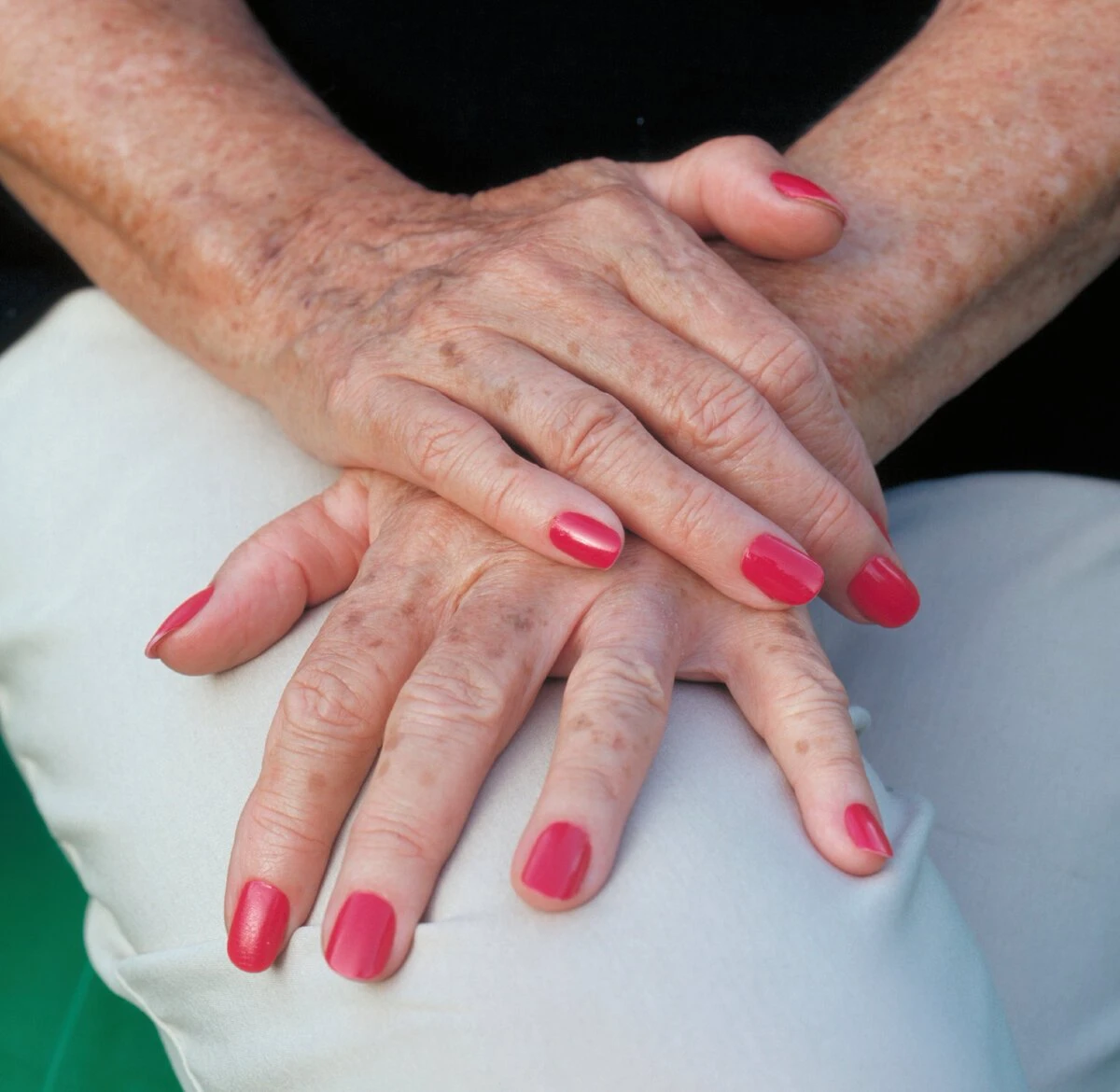 main taches brunes manicures rouge femme 60 ans