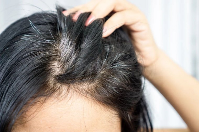 closeup asian woman having problem with grey, white hair growing up