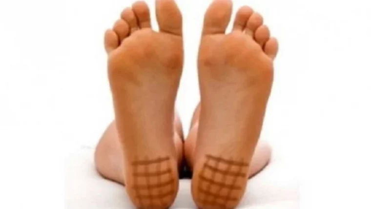 comment savoir si on est en carence d iode pieds grille