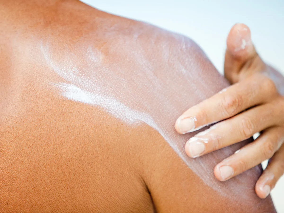 comment traiter une peau qui pele apres un coup de soleil